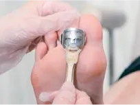 足爪ケア+角質ケア